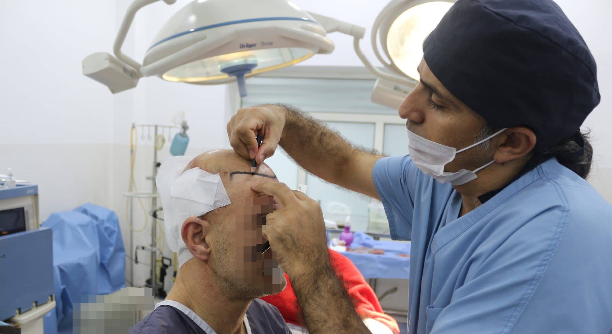 Chute de cheveux chirurgie